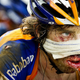 Illustration for article titled Hamburger Face Wont Keep This Tour De France Rider Down